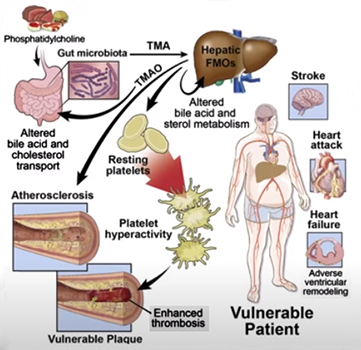 Great importance of Healthy Guts - microbiome